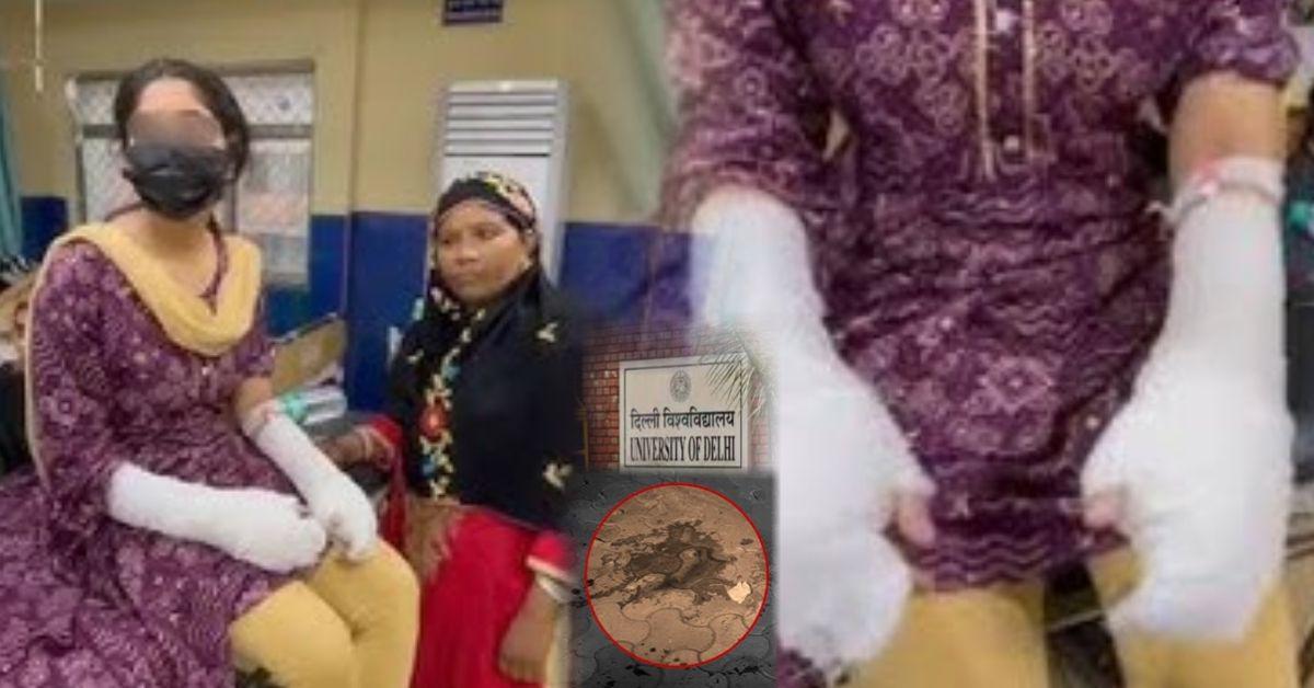 दिल्ली यूनिवर्सिटी छात्रा पर एसिड अटैक: आरोपी अब तक फरार